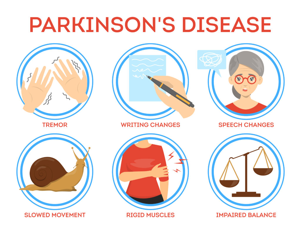 Illustration showing symptoms of Parkinson's disease