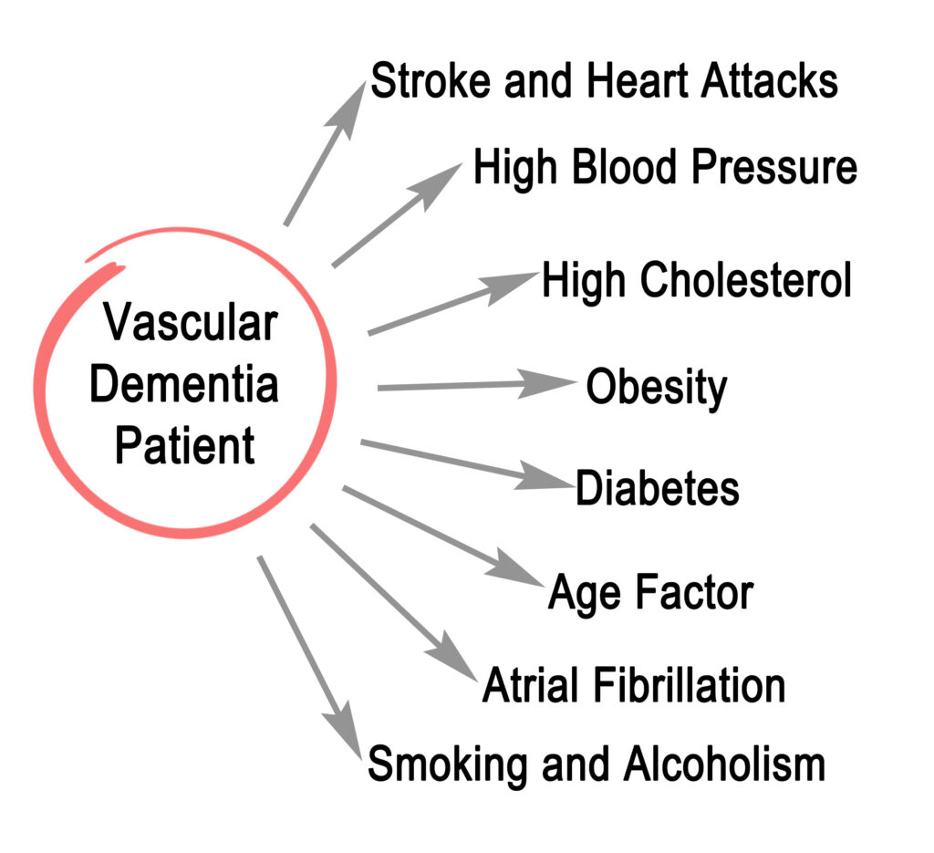 Illustration showcasing symptoms of vascular dementia.